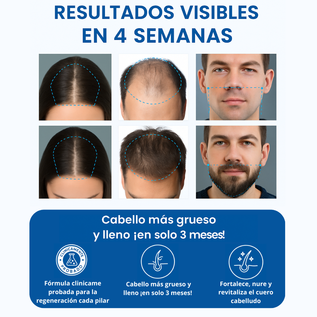 Sérum Roll-On Avanzado para el Crecimiento del Cabello
