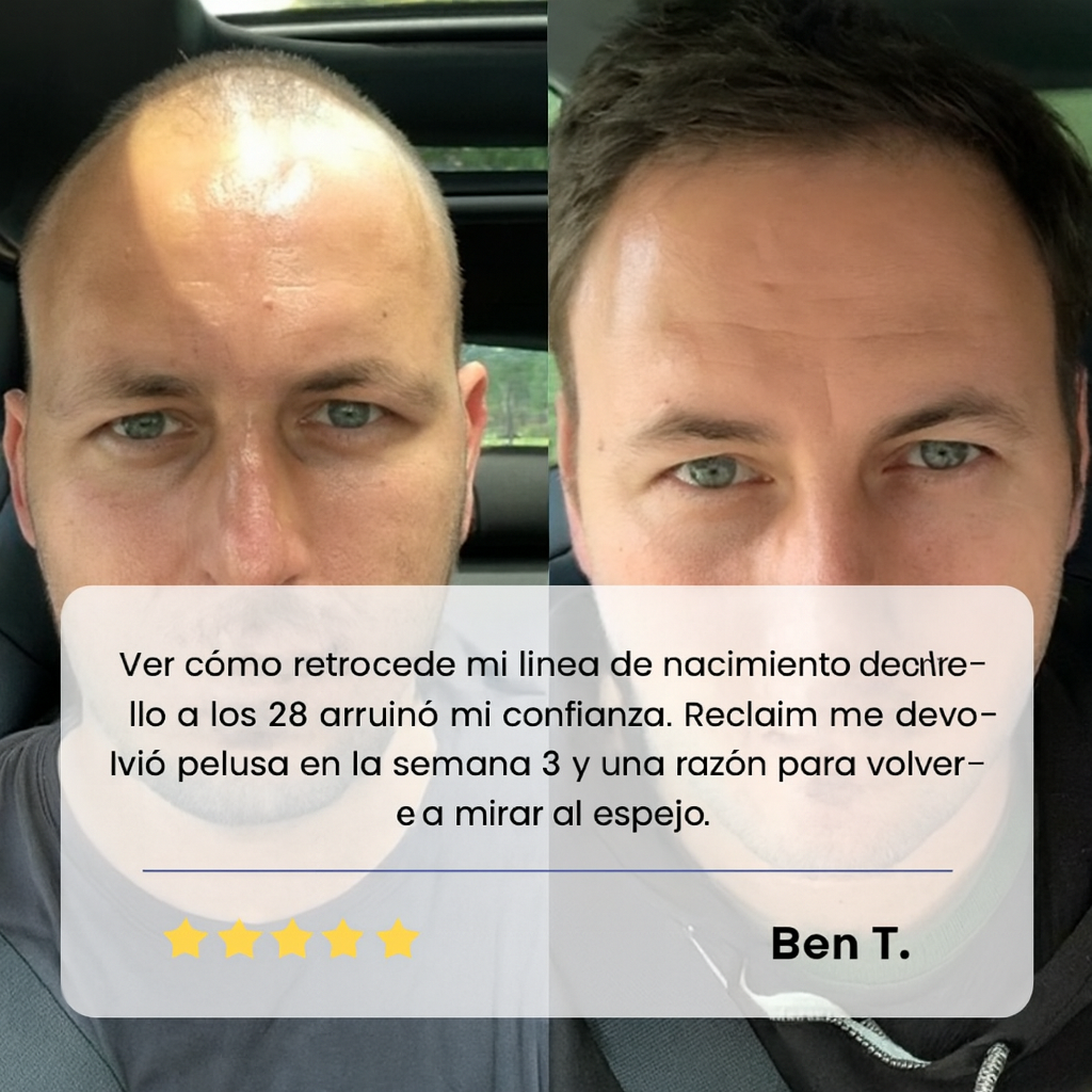 Sérum Roll-On Avanzado para el Crecimiento del Cabello