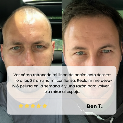 Sérum Roll-On Avanzado para el Crecimiento del Cabello